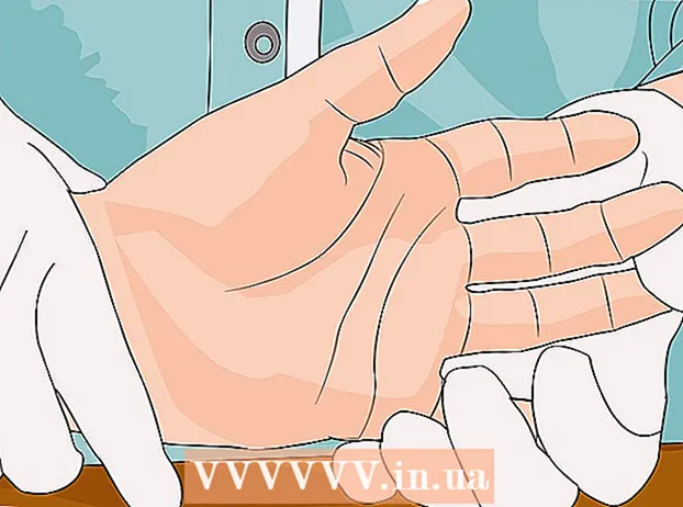 Behandling af en knækket finger