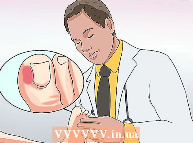علاج اصبع القدم الملتهب