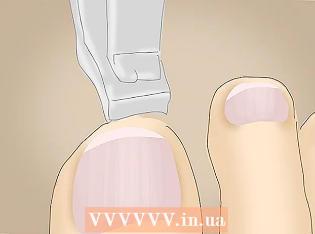 Tratando um dedo do pé dolorido