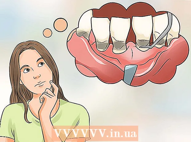 Prevent itchy gums