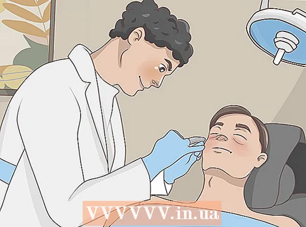 Cum să scapi de acnee în mod natural