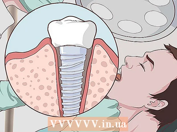 Behandling af periodontal sygdom