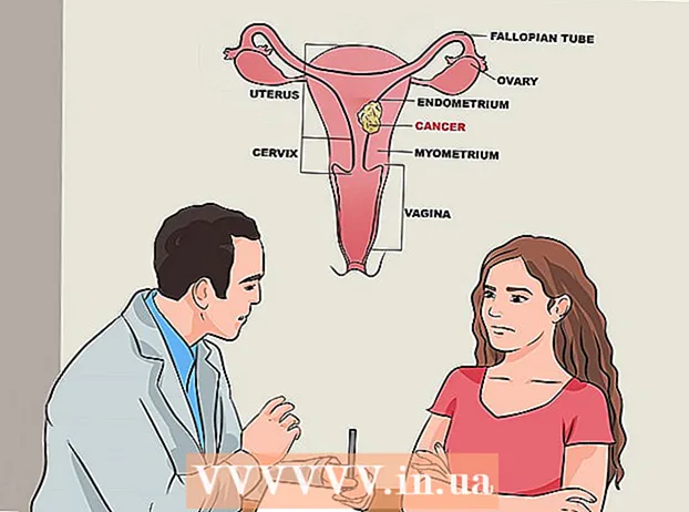 Reconèixer els símptomes de la síndrome de l’ovari poliquístic