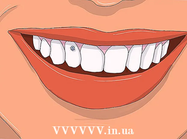 Наношење зубног накита