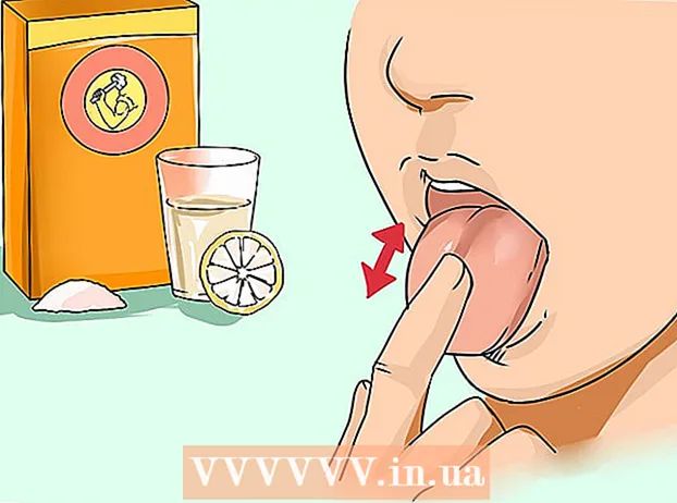 How to get rid of a white tongue