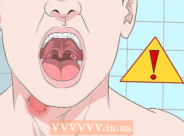 Cómo deshacerse del dolor de garganta