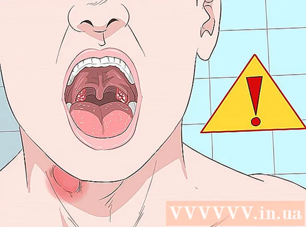 Как да излекувате бързо възпалено гърло