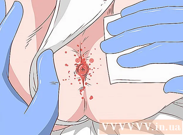 Hur man botar hemorrojder med trollhassel