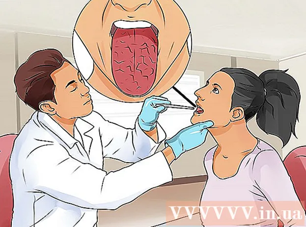 Möglichkeiten, Mundgeruch zu heilen