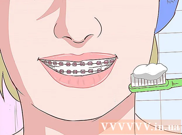 How to cure a cold sore