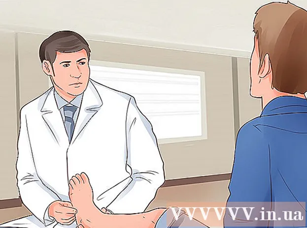 Cum să vindeci un deget de la picior rupt