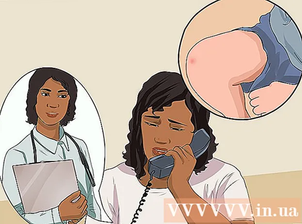 Cum să vindeci un genunchi zgâriat
