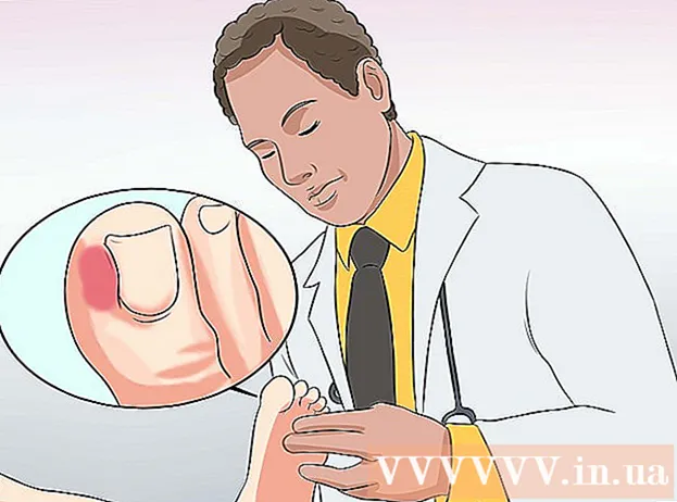 Hoe een geïnfecteerde teen te genezen