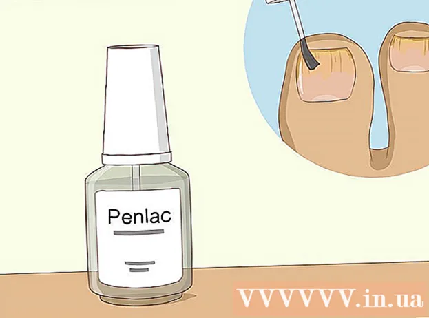 How to cure toenail fungus with vinegar