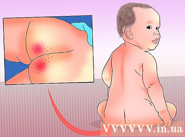 Manieren om diarree bij baby's te genezen