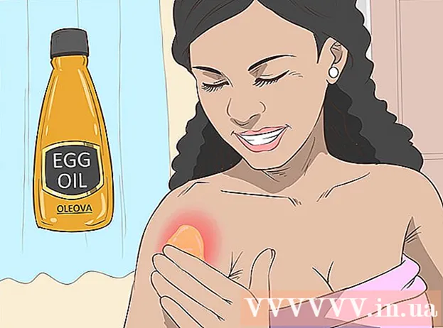 How to Treat Sunburn Skin