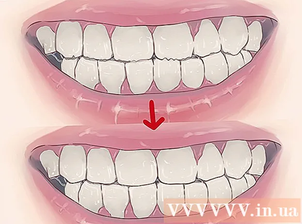 Πώς να θεραπεύσετε το τρίψιμο των δοντιών τη νύχτα