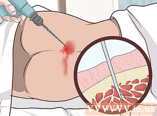 Ways to Diagnose Fanconi Anemia