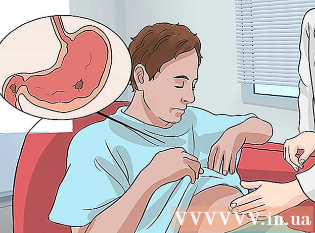 Ways to relieve indigestion