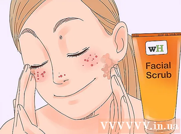 Ways to Reduce Red Pimples