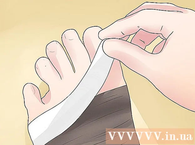 Cómo tratar un esguince de tobillo