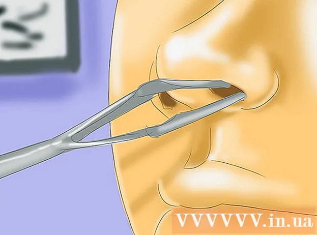 Kaip sustabdyti kraujavimą iš nosies, laikant nosį drėgną