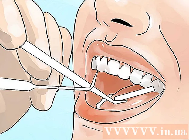 דרכים להלבין שיניים