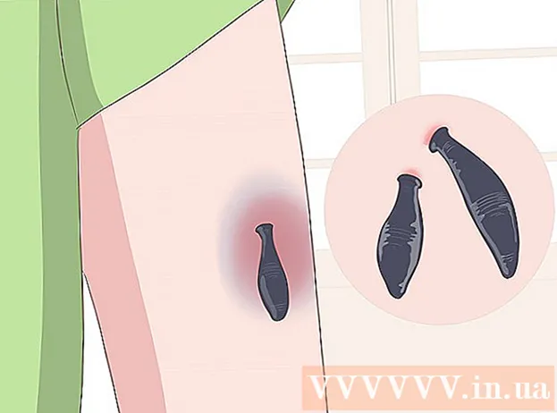 How to make a bruise go away quickly