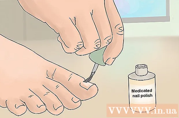 Hvordan bli kvitt hvite flekker på negler