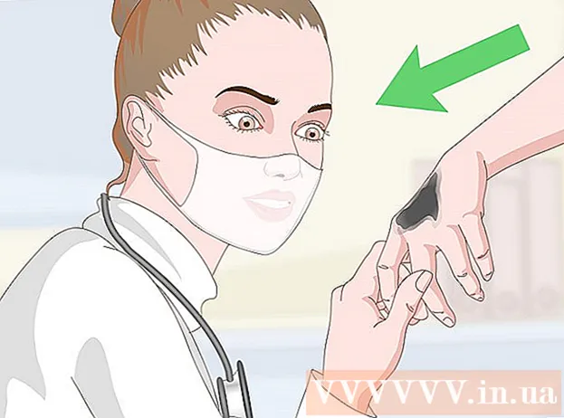 Como se livrar do alcatrão da pele