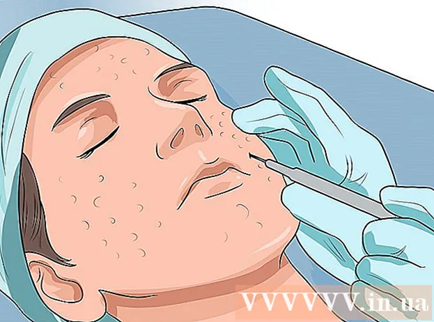 Hoe grote poriën en puistjes in het gezicht te verwijderen