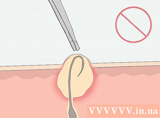 Hoe u ingegroeide haartjes in de bikinilijn kunt verwijderen