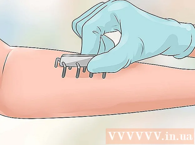Cómo deshacerse del acné en las nalgas.