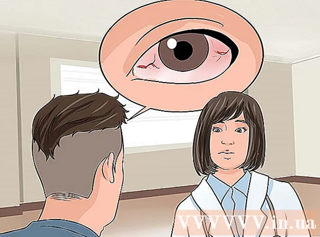Hur man får kontaktlinser som sitter fast i ögonen