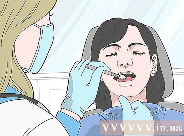 Cara makan saat pertama kali memakai atau mengencangkan kawat gigi
