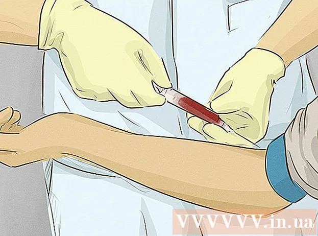 طرق الوقاية من فقر الدم