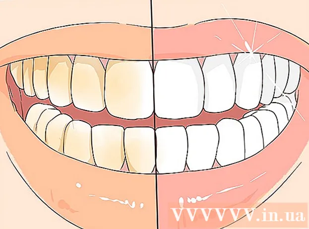 Manieren om tandsteen te voorkomen
