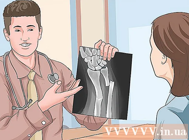 Kako prepoznati zlom brez rentgenskega slikanja