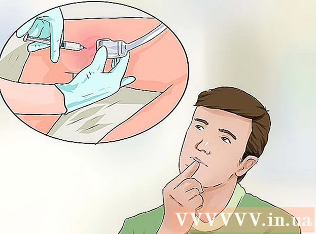 Ways to prevent varicose veins