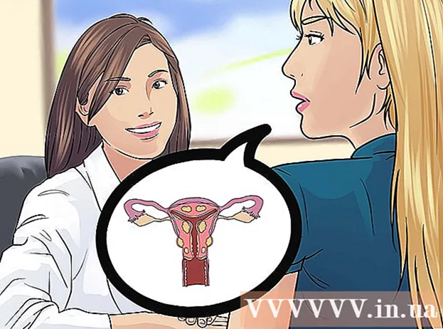 Tapoja estää kohdun fibroideja
