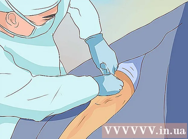 Hvordan behandle kneforstuvning