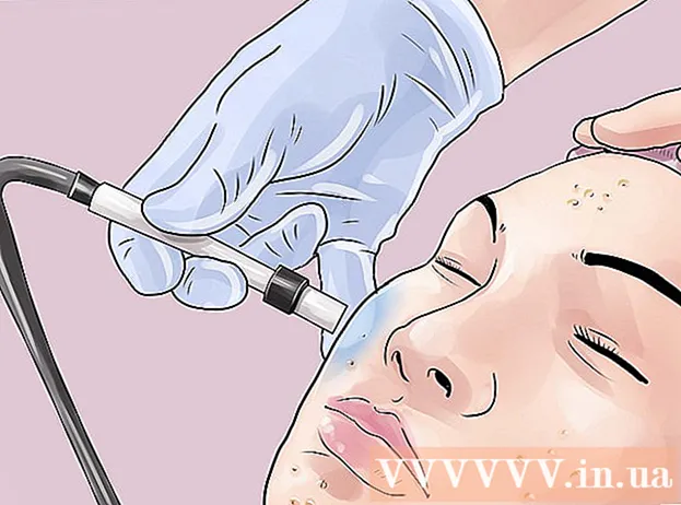 Modi per trattare l'acne