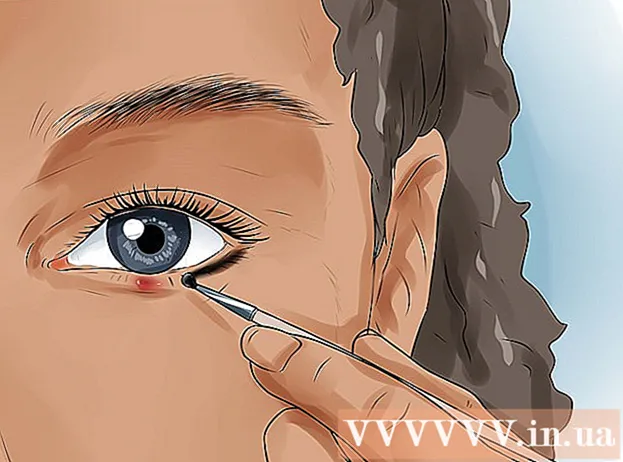 How to treat eyelid streaks