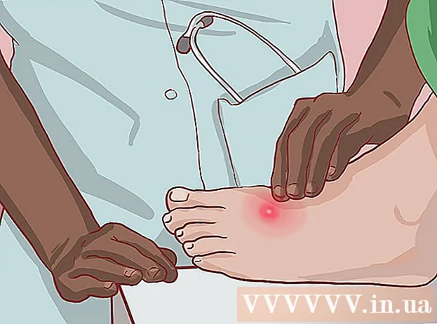 Wéi pimples ze behandelen oder Réckwee