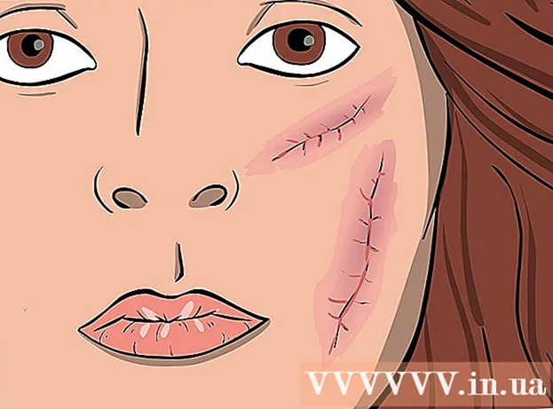 Sådan behandles cystisk acne effektivt