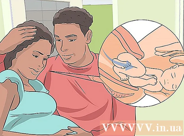 طرق تجنب الولادة القيصرية