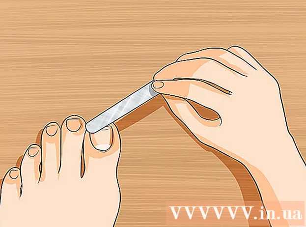 Comment traiter un ongle jaune