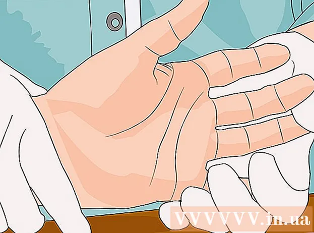 Hur man behandlar ett knäckt finger