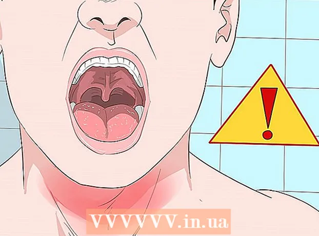 Kako se hitro znebiti vnetja grla