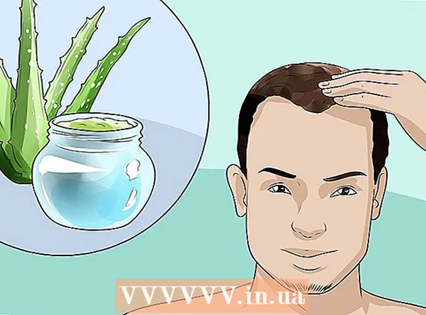 男性型脱毛症に対処する方法